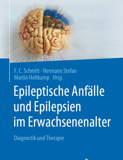 Epileptische Anfälle und Epilepsien im Erwachsenenalter: Diagnostik und Therapie (German Edition)