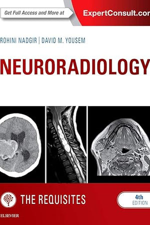 Neuroradiology: The Requisites (The Core Requisites)