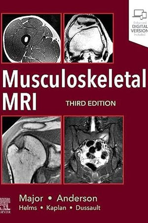 Musculoskeletal MRI