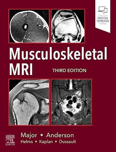 Musculoskeletal MRI