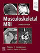 Musculoskeletal MRI