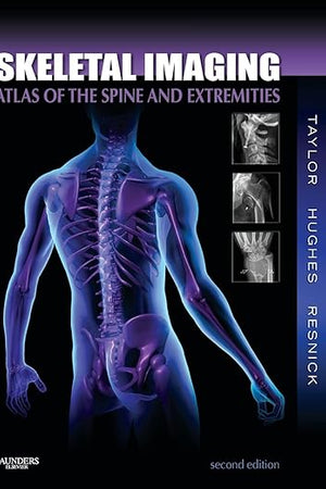Skeletal Imaging: Atlas of the Spine and Extremities