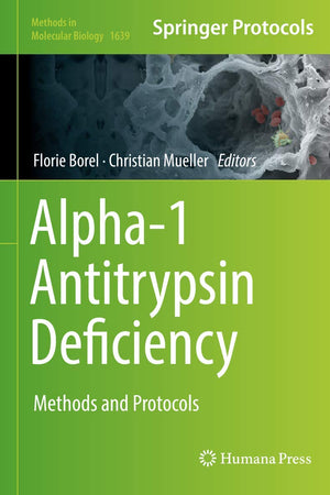 Alpha-1 Antitrypsin Deficiency: Methods and Protocols (Methods in Molecular Biology, 1639)