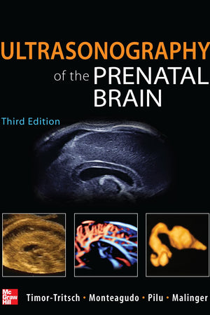 Ultrasonography of the Prenatal Brain, Third Edition