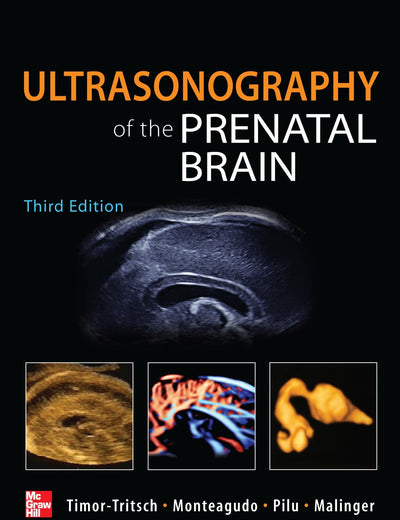 Ultrasonography of the Prenatal Brain, Third Edition