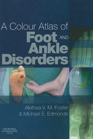 A Colour Atlas of Foot and Ankle Disorders