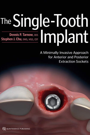 The Single-Tooth Implant: A Minimally Invasive Approach for Anterior and Posterior Extraction Sockets