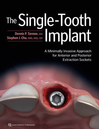 The Single-Tooth Implant: A Minimally Invasive Approach for Anterior and Posterior Extraction Sockets