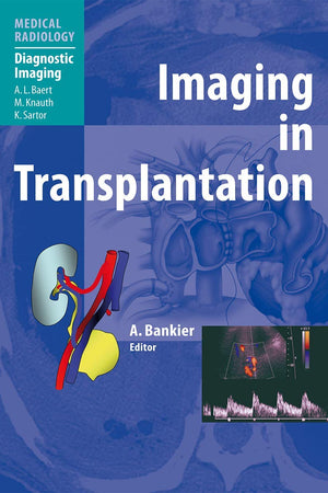 Imaging in Transplantation (Diagnostic Imaging)