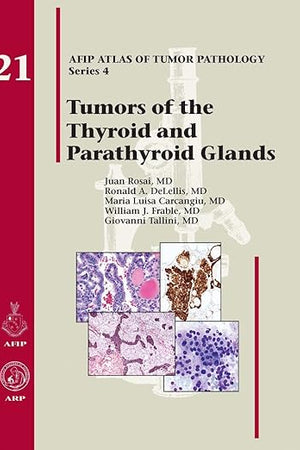 Tumors of the Thyroid Glands