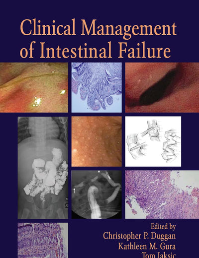Clinical Management of Intestinal Failure