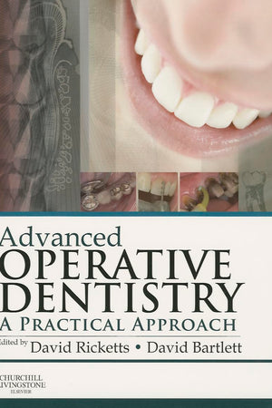 Advanced Operative Dentistry: A Practical Approach