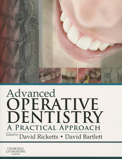 Advanced Operative Dentistry: A Practical Approach