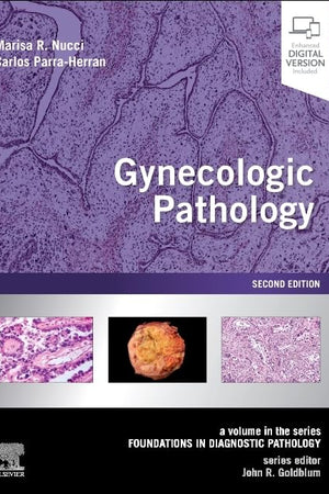Gynecologic Pathology: A Volume in Foundations in Diagnostic Pathology Series