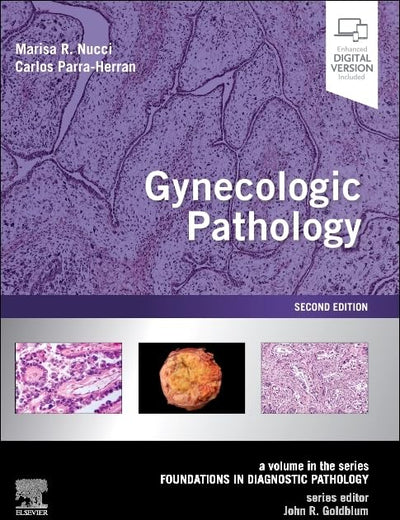 Gynecologic Pathology: A Volume in Foundations in Diagnostic Pathology Series