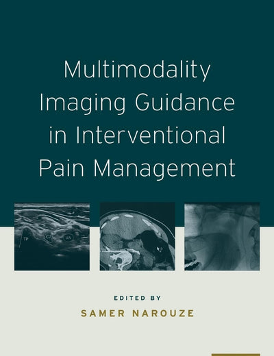 Multimodality Imaging Guidance in Interventional Pain Management