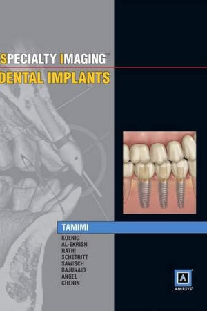 Specialty Imaging: Dental Implants
