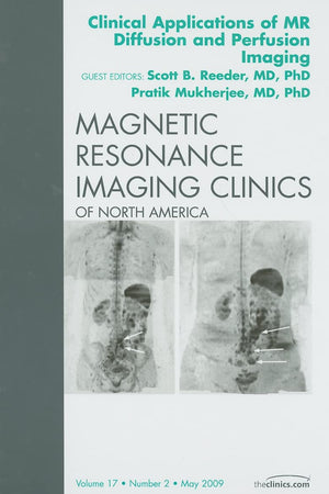 Clinical Applications of MR Diffusion and Perfusion Imaging, An Issue of Magnetic Resonance Imaging Clinics (Volume 17-2) (The Clinics: Internal Medicine, Volume 17-2)