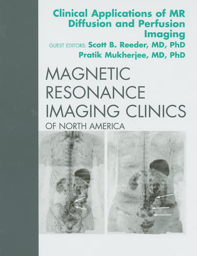 Clinical Applications of MR Diffusion and Perfusion Imaging, An Issue of Magnetic Resonance Imaging Clinics (Volume 17-2) (The Clinics: Internal Medicine, Volume 17-2)