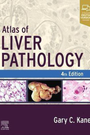 Atlas of Liver Pathology (Atlas of Surgical Pathology)