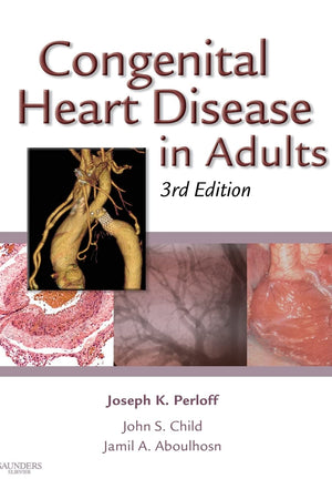 Congenital Heart Disease in Adults (Congenital Heart Disease in Adults (Perloff/Child))