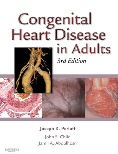 Congenital Heart Disease in Adults (Congenital Heart Disease in Adults (Perloff/Child))