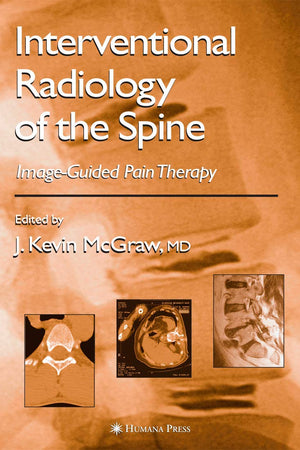 Interventional Radiology of the Spine: Image-Guided Pain Therapy