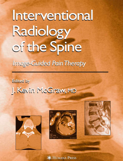 Interventional Radiology of the Spine: Image-Guided Pain Therapy