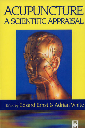 Acupuncture: Acupuncture