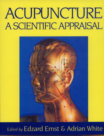 Acupuncture: Acupuncture