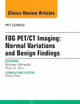 FDG PET/CT Imaging: Normal Variations and Benign Findings – Translation to PET/MRI, An Issue of PET Clinics (The Clinics: Radiology)