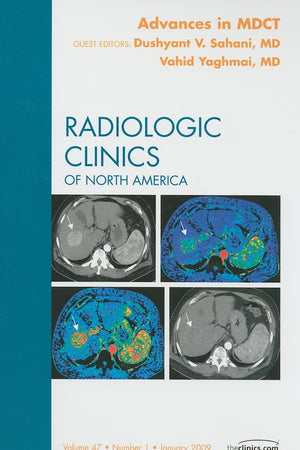 Advances in MDCT, An Issue of Radiologic Clinics (Volume 47-1) (The Clinics: Radiology, Volume 47-1)