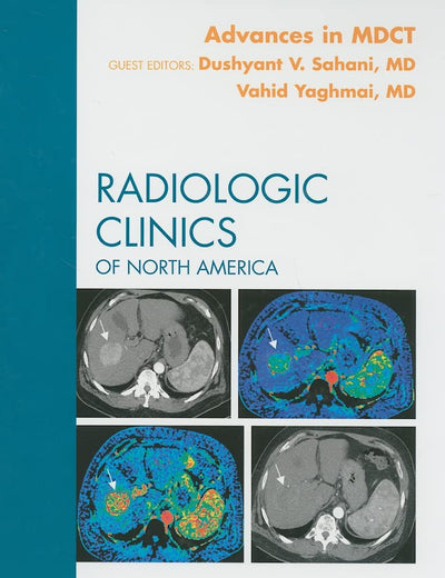 Advances in MDCT, An Issue of Radiologic Clinics (Volume 47-1) (The Clinics: Radiology, Volume 47-1)
