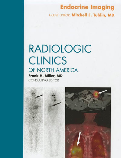 Endocrine Imaging, An Issue of Radiologic Clinics of North America (Volume 49-3) (The Clinics: Radiology, Volume 49-3)