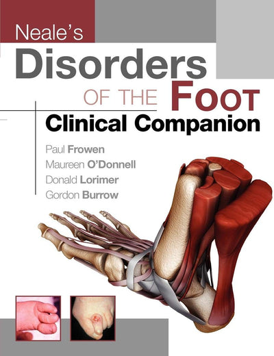 Neale's Disorders of the Foot Clinical Companion
