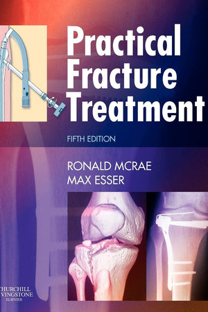 Practical Fracture Treatment