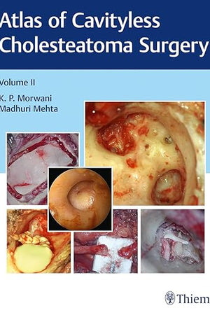 Atlas of Cavityless Cholesteatoma Surgery, Vol 2