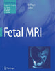Fetal MRI (Medical Radiology)