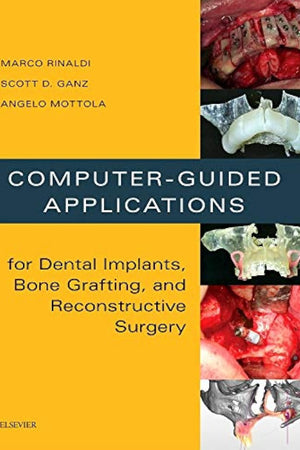 Computer-Guided Applications for Dental Implants, Bone Grafting, and Reconstructive Surgery (adapted translation)