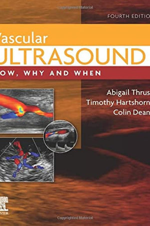 Vascular Ultrasound: How, Why and When