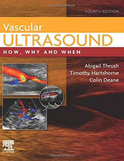 Vascular Ultrasound: How, Why and When