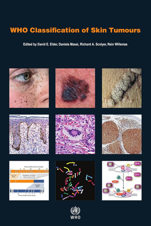 WHO Classification of Skin Tumours [OP]
