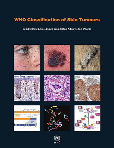 WHO Classification of Skin Tumours [OP]