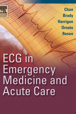 ECG in Emergency Medicine and Acute Care