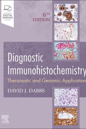 Diagnostic Immunohistochemistry: Theranostic and Genomic Applications
