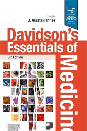 Davidson's Essentials of Medicine