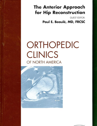 The Anterior Approach for Hip Reconstruction, An Issue of Orthopedic Clinics (Volume 40-3) (The Clinics: Orthopedics, Volume 40-3)