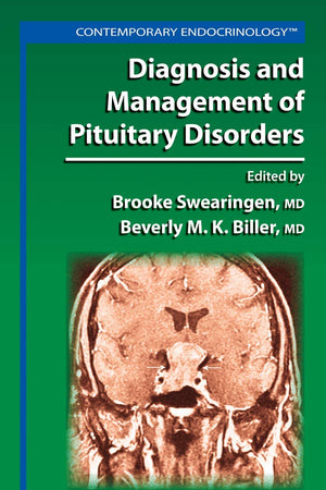 Diagnosis and Management of Pituitary Disorders (Contemporary Endocrinology)