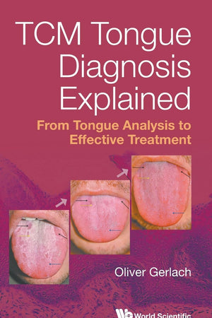 Tcm Tongue Diagnosis Explained: From Tongue Analysis To Effective Treatment