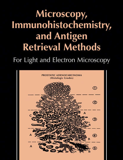 Microscopy, Immunohistochemistry, and Antigen Retrieval Methods: For Light and Electron Microscopy